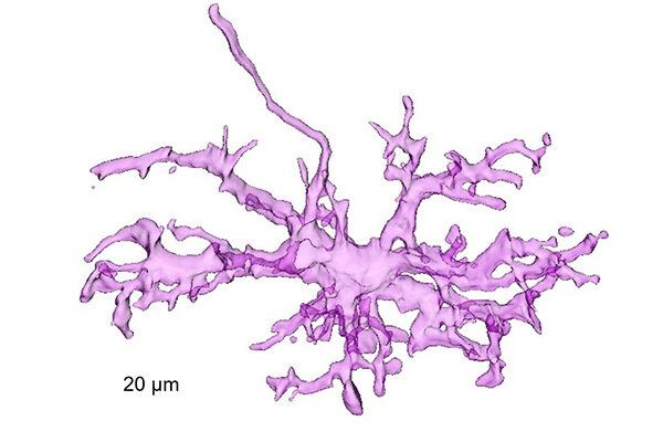 Brain immune cell defect may help explain social impairments in males with autism