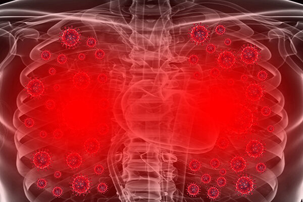 Clinical trial in COVID-19 patients tests anti-inflammatory drug developed 25 years ago at Scripps Research