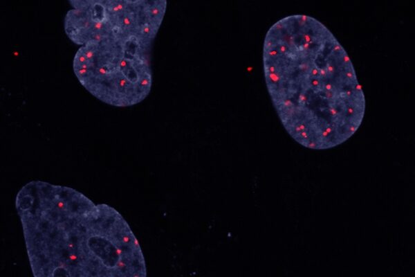 Cancer cells’ growth amid crowding reveals nuanced role for known oncogene