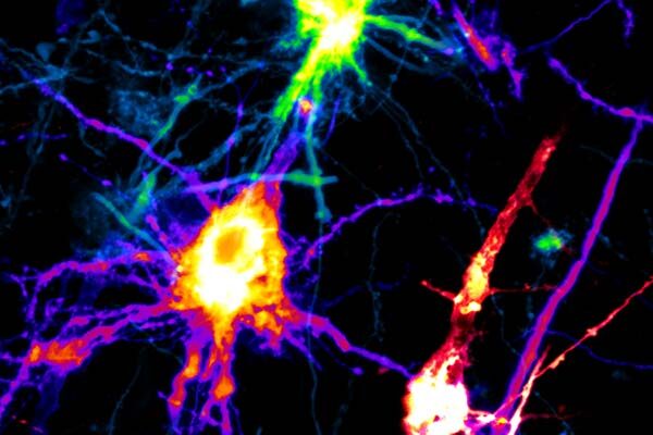 Brain’s immune cells are a central driver of alcohol use disorder