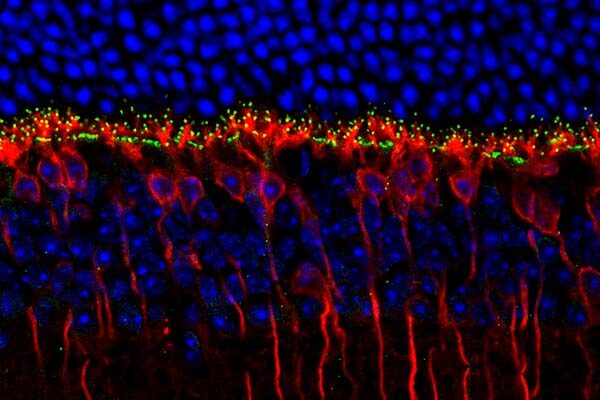 Wiring the eyes to the brain for color vision