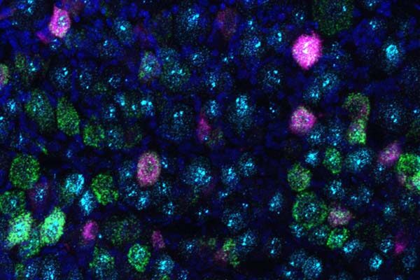 Scientists identify sensor protein that underlies bladder control