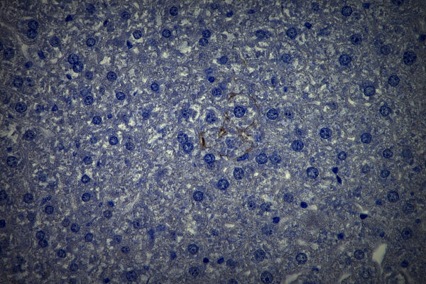 Study shows main cell type in the liver has key role in defending against some viruses