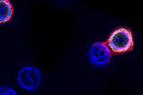 Rapid method of isolating tumor-targeting T cells could propel personalized cancer treatments