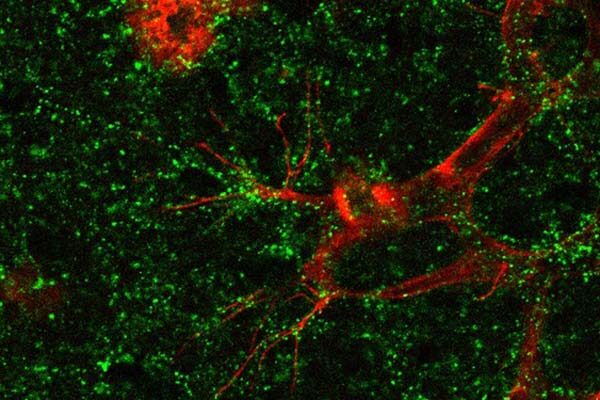 New strategy for treating common retinal diseases shows promise