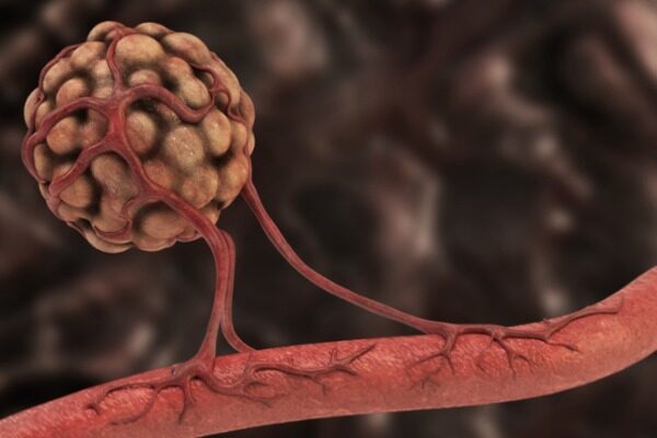 Enzyme discovery is missing piece in understanding how to rein in blood vessels that fuel cancer