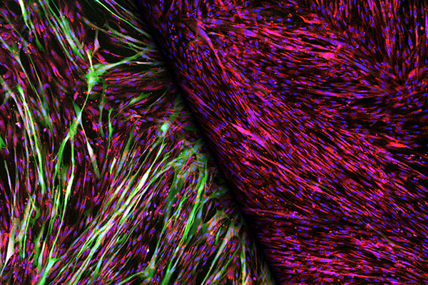 Targeting muscle cells’ insulin receptors allows more efficient gene therapy