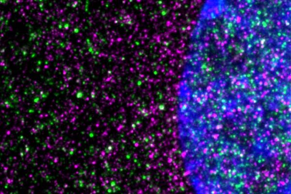 Huntington’s disease may be driven by slowed protein-building machinery in cells