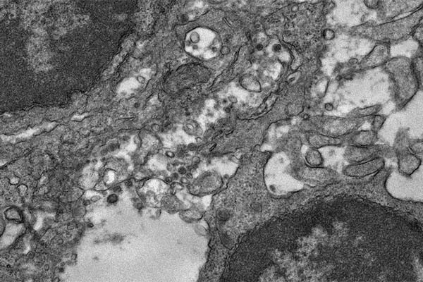 Experimental COVID-19 vaccine appears to work well against variants of concern