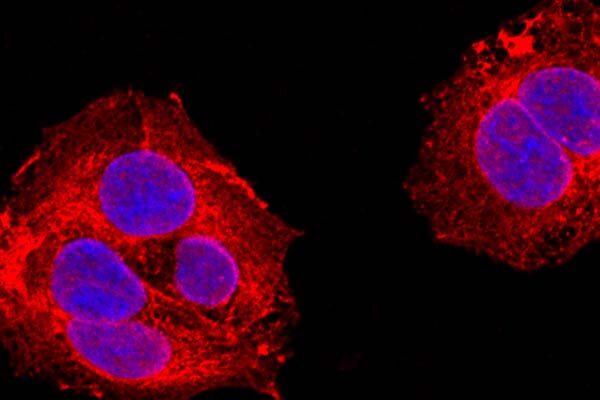 Why do protein-making enzymes cluster together? Not for the reason many think
