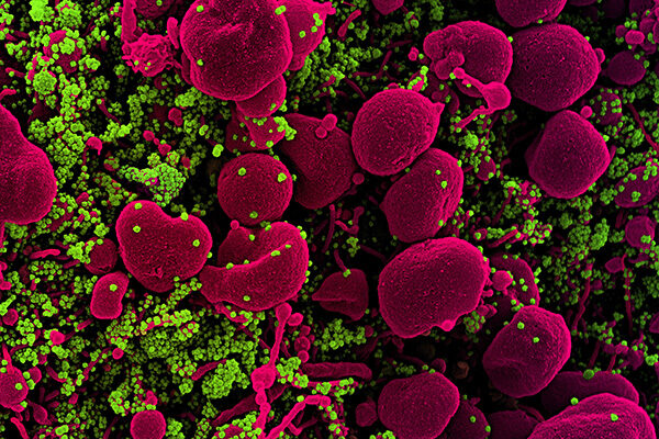 Potential drug against COVID-19 found among tapeworm medications