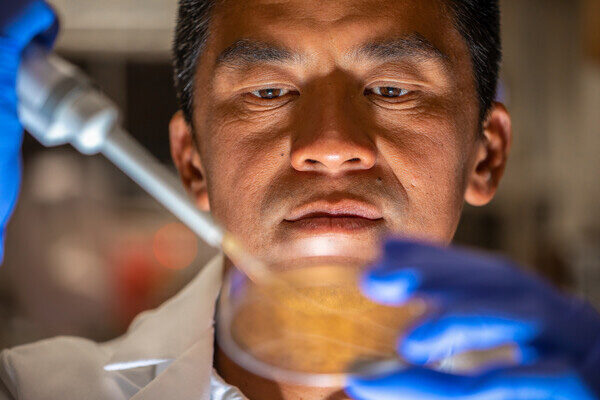 Species of gut bacteria boosts response to cancer immunotherapy—and now we know why