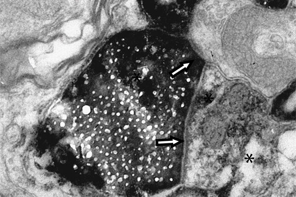 Scripps Research discovers new type of cellular communication in the brain