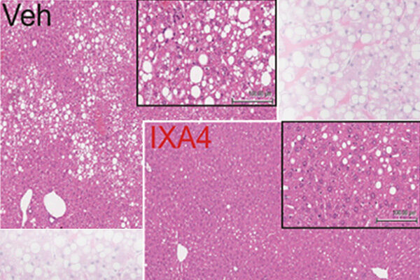Scripps Research scientists unveil promising new approach to diabetes prevention