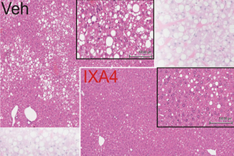 Scripps Research scientists unveil promising new approach to diabetes prevention