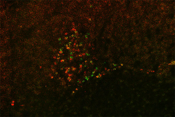 Scripps Research scientists hunt for neurons responsible for alcohol withdrawal