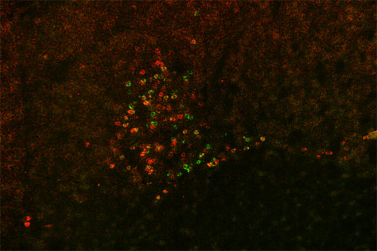 Scripps Research scientists hunt for neurons responsible for alcohol withdrawal