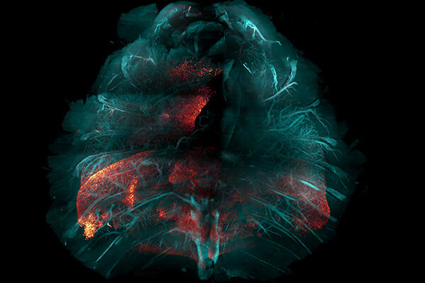 New method for making tissue transparent could speed the study of many diseases