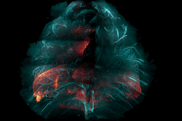 New method for making tissue transparent could speed the study of many diseases