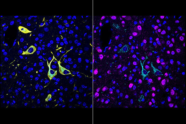 New technique shows in detail where drug molecules hit their targets in the body