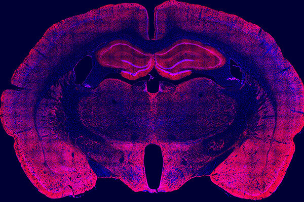 Scripps Research study reveals how alcohol cravings get stronger after drinking during withdrawal