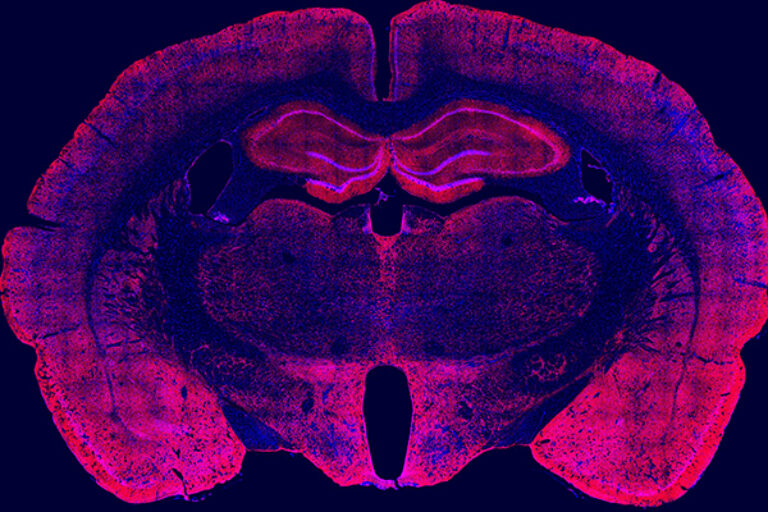 Scripps Research study reveals how alcohol cravings get stronger after drinking during withdrawal