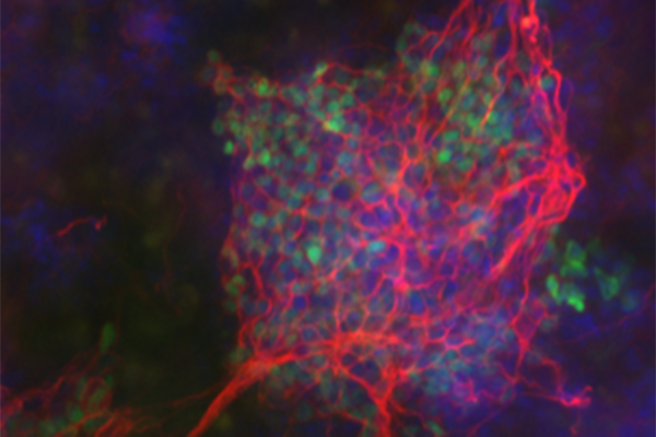 Sugared proteins called proteoglycans start to give up their secrets
