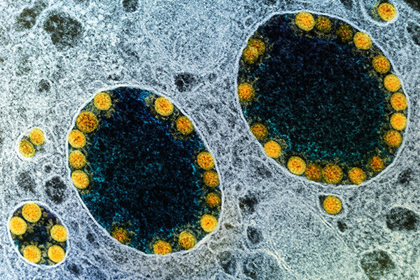 Scripps Research awarded $67 million by NIH to lead new pandemic preparedness center