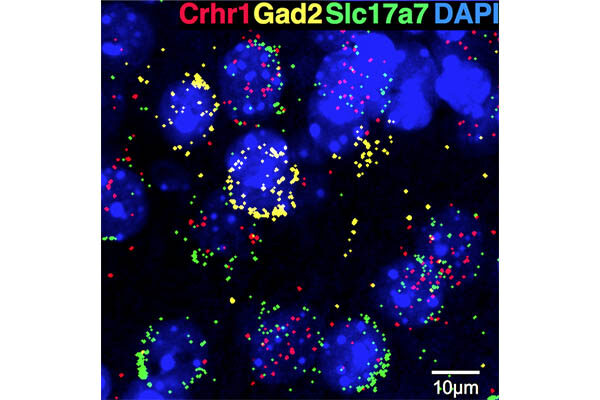 Immune protein may drive alcoholism relapse