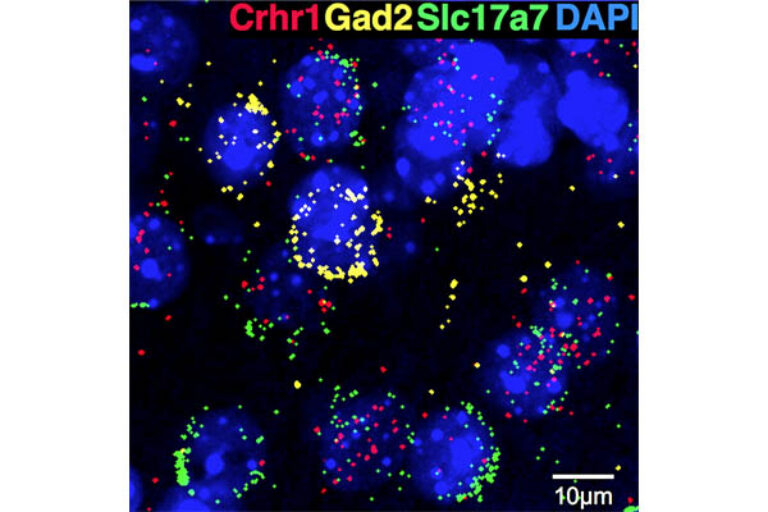 Immune protein may drive alcoholism relapse
