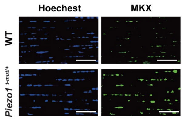 Gene variant gives mice super-powered tendons for jumping and running