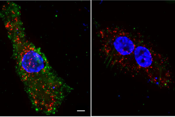 Immune system uses two-step verification to defend against HIV