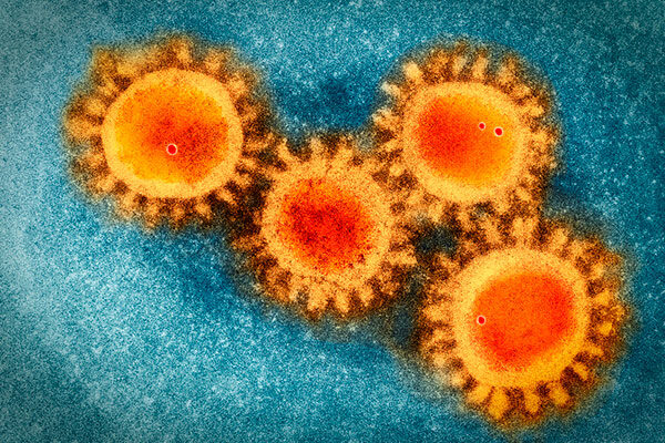 Scripps Research scientists identify how SARS-CoV-2 spreads in the Middle East