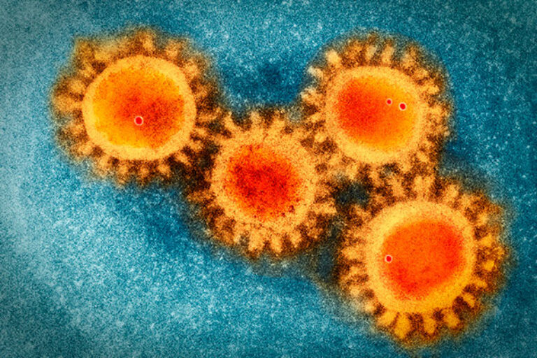 Scripps Research scientists identify how SARS-CoV-2 spreads in the Middle East