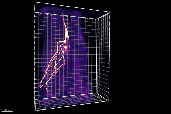Scripps Research scientists eavesdrop on communication between fat and brain