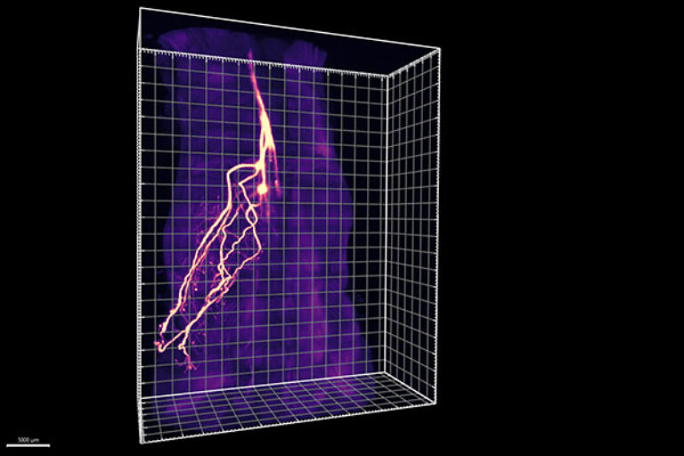 Scripps Research scientists eavesdrop on communication between fat and brain