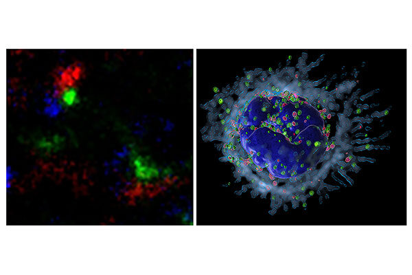 Scripps Research discovery suggests new strategy against harmful inflammation