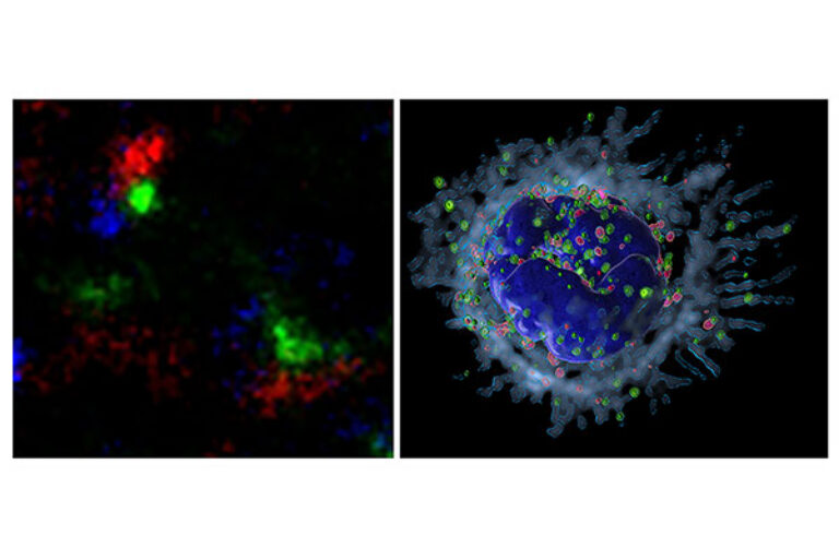 Scripps Research discovery suggests new strategy against harmful inflammation