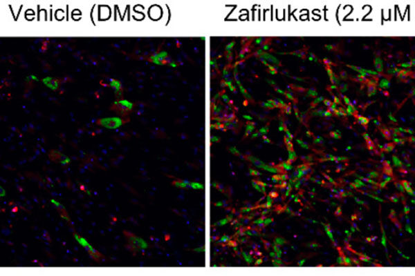 Drug discovery method identifies naturally occurring metabolite that converts ‘bad’ fat to ‘good’ fat