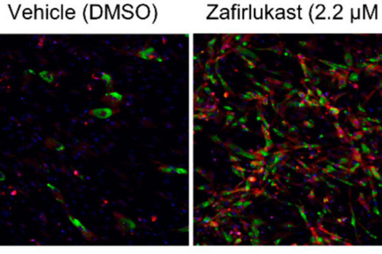 Drug discovery method identifies naturally occurring metabolite that converts ‘bad’ fat to ‘good’ fat