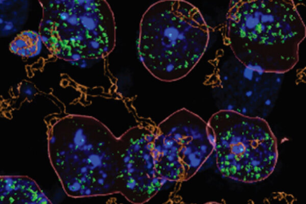 How heavy alcohol consumption increases brain inflammation