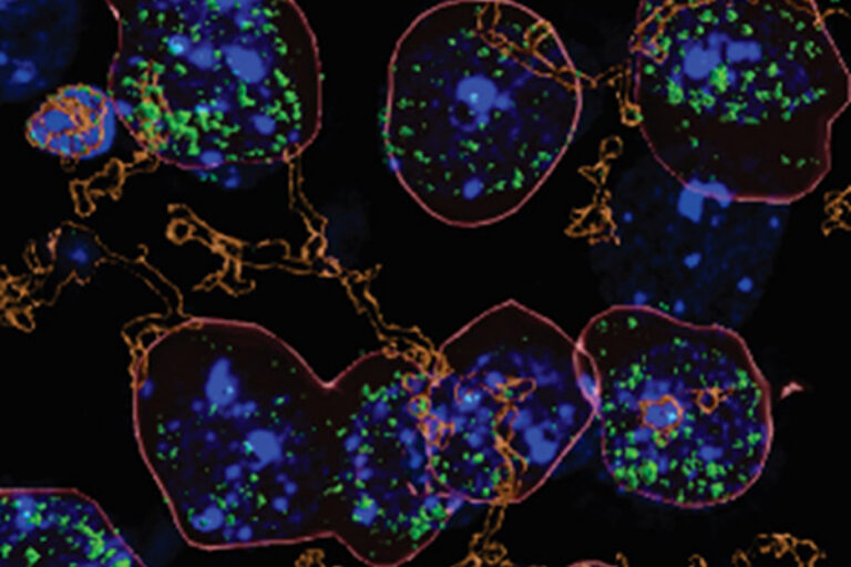 How heavy alcohol consumption increases brain inflammation
