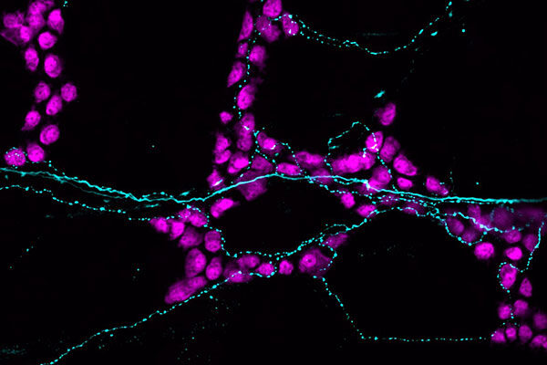 How sensory neurons impact the gut