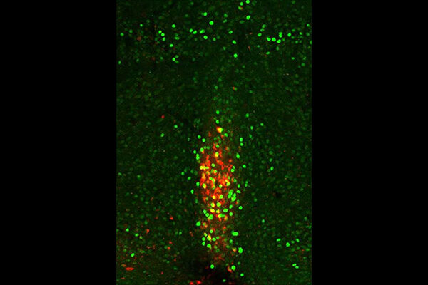 How cold temperatures trigger the brain to boost appetite