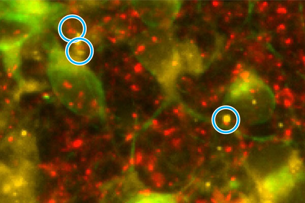 Re-energizing mitochondria to treat Alzheimer’s disease