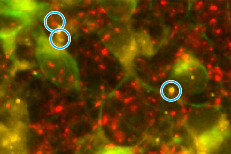 Re-energizing mitochondria to treat Alzheimer’s disease