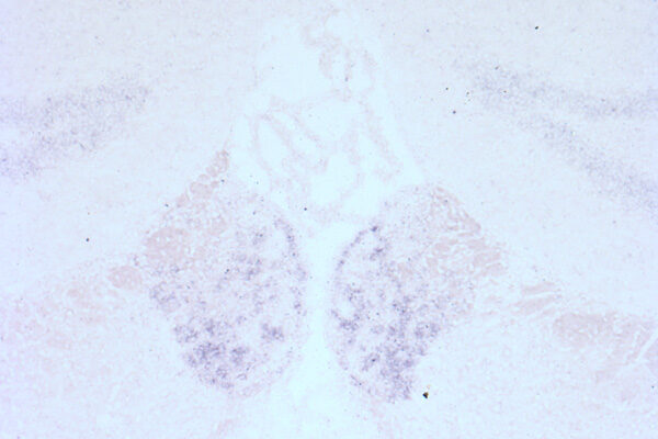 Scripps Research scientists give new insight into a molecular target of alcohol