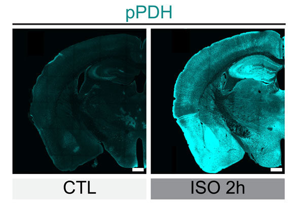 New technology lets researchers track brain cells’ “off switches”