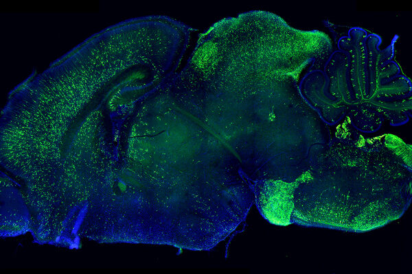 New method to reveal what drives brain diseases
