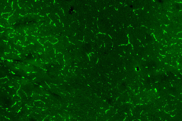 Researchers identify brain region involved in oxycodone relapse